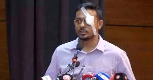 চোখে ব্যান্ডেজ নিয়ে বক্তব্য দিলেন নাসীরুদ্দীন পাটওয়ারী