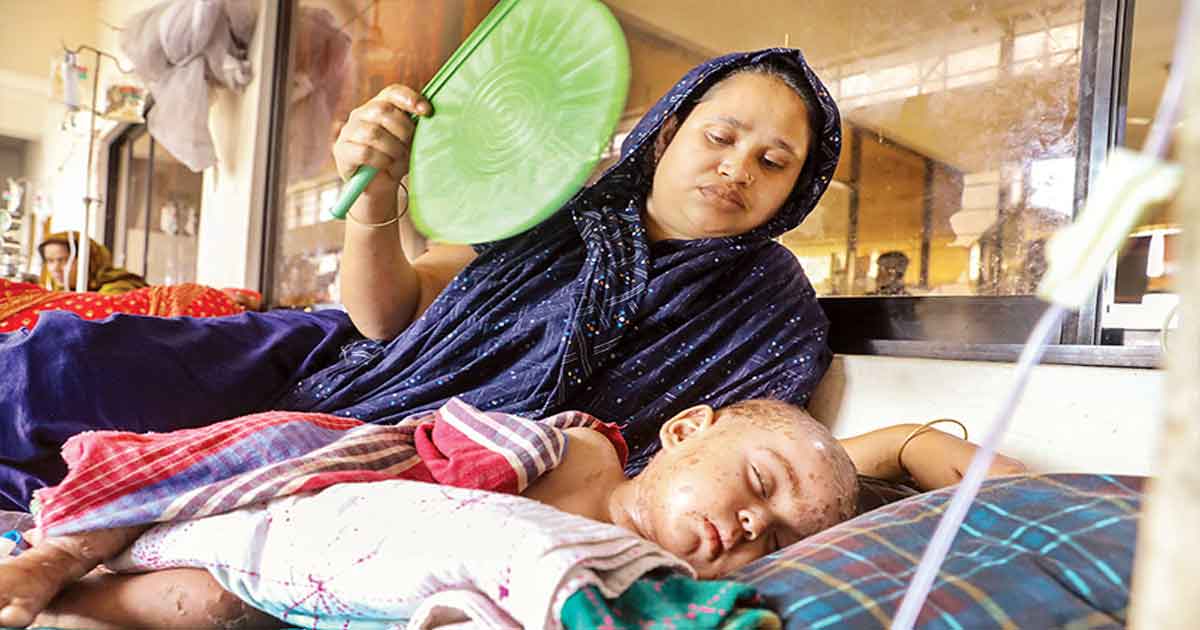 হাম আক্রান্ত শিশু, ছবিঃ সংগৃহীত 