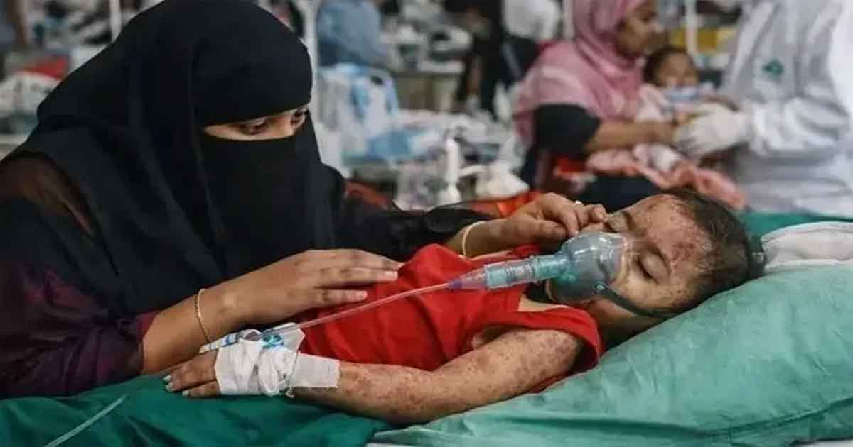 হামে আক্রান্ত শিশু, ছবিঃ সংগৃহীত 